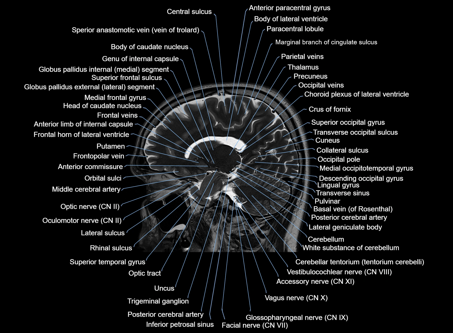 brain sagittal anatomy 3T MRI images -img-00001-00026.webp